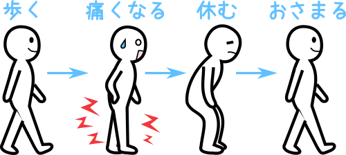 痛い 歩く と おしり が 【体験談】お尻の穴（肛門）が痛い原因と対処方法を紹介！